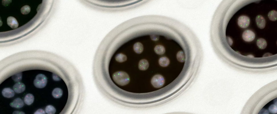 Rare Diseases: Reverse Engineering for Drug Development